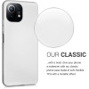 KW Xiaomi Mi 11 Lite / Mi 11 Lite 5G Θήκη Σιλικόνης TPU - Metallic Silver - 54727.67